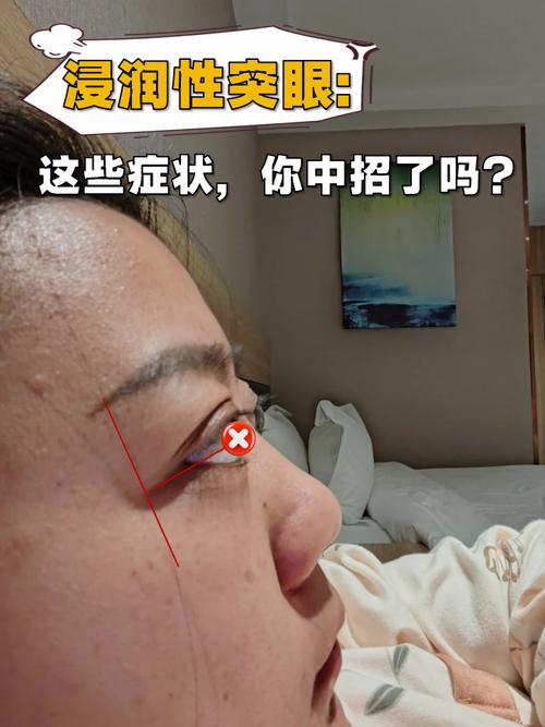 突眼是什么