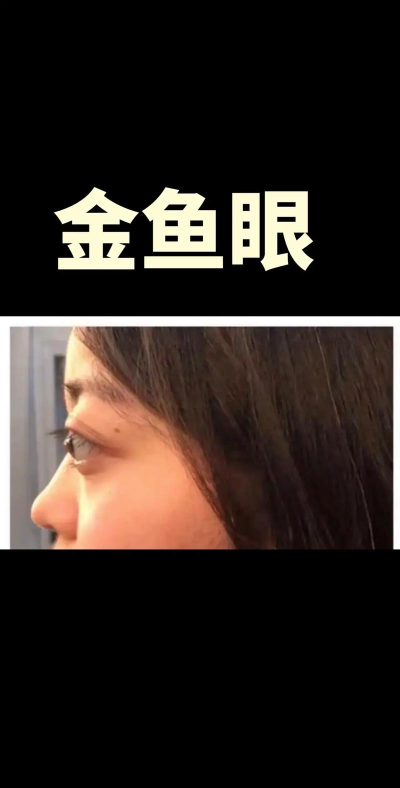 突眼是什么