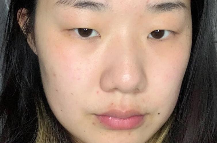 什么的小眼睛