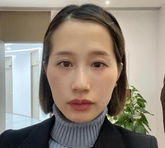 颧骨突出是什么脸型