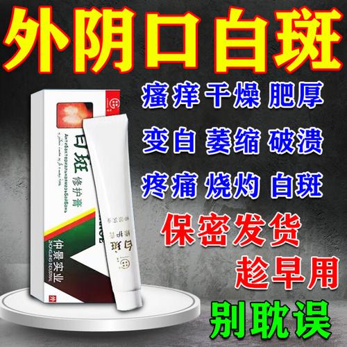 外阴痒涂什么药膏