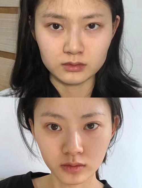 瘦脸针和减肥的效果有什么区别