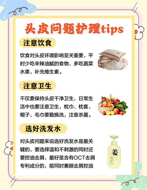 头癣是什么引起的