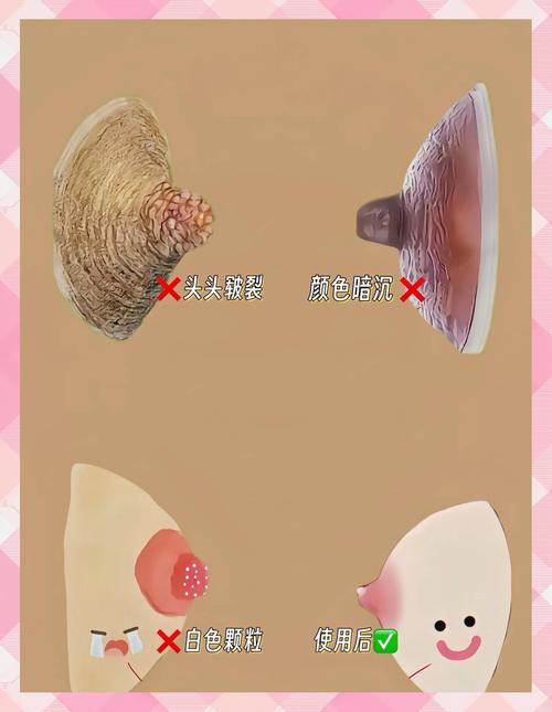 乳头有什么颜色