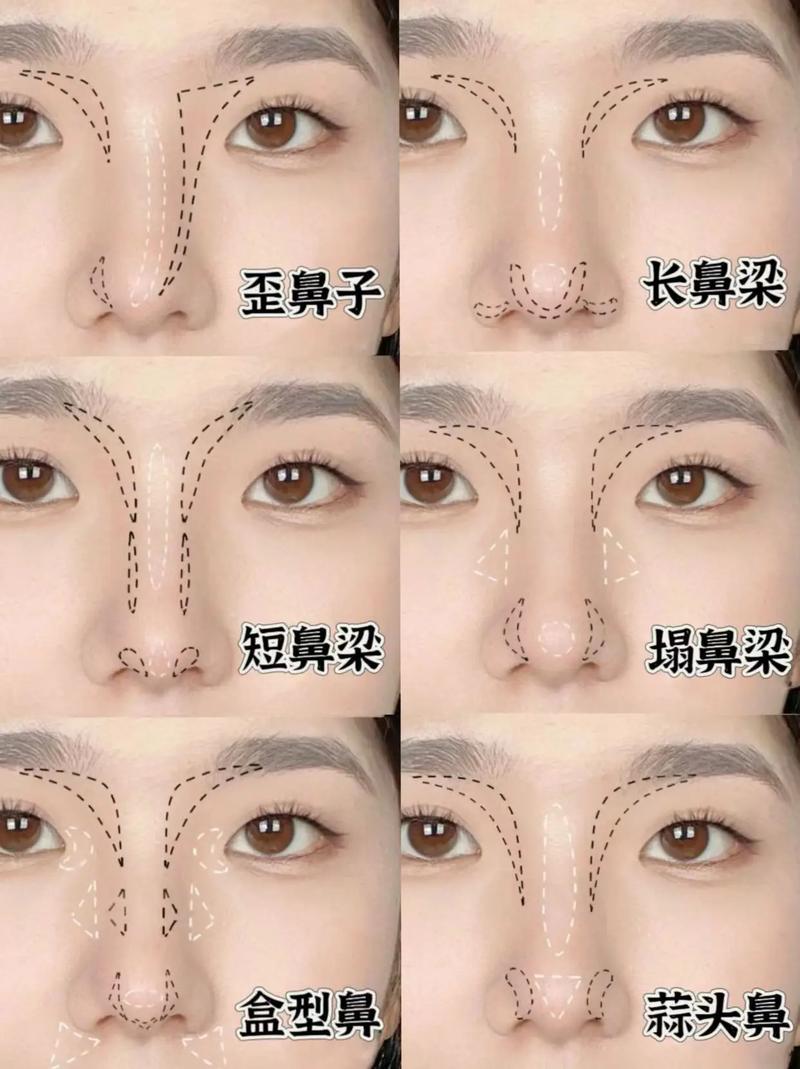 鼻孔什么形状好看