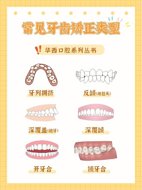 什么是口腔正畸