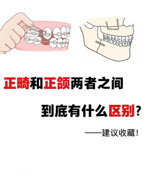 什么是口腔正畸
