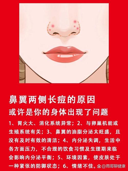 鼻翼痘痘是什么原因