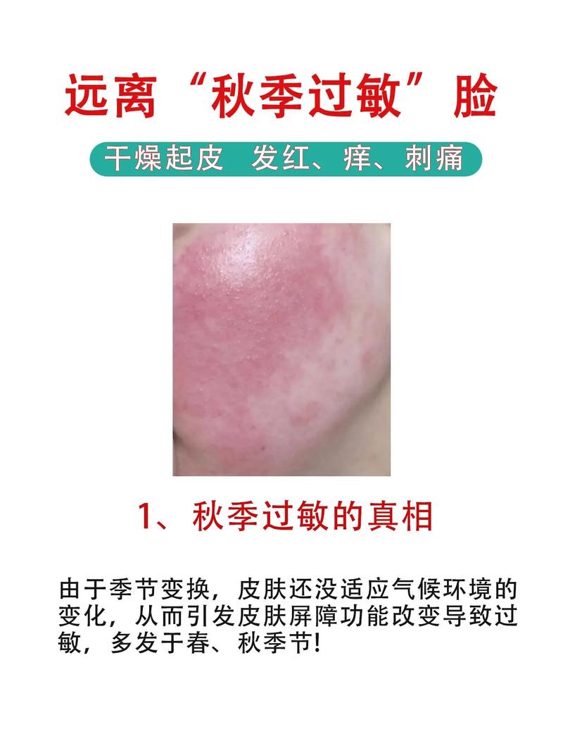 皮肤过敏喝什么