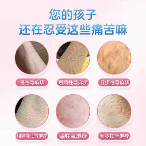 皮肤过敏喝什么