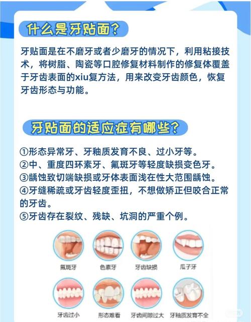 牙齿贴面什么意思