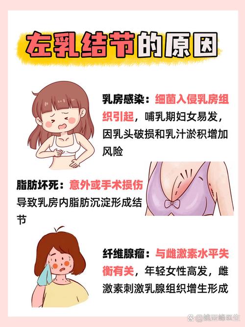 乳房为什么有结节