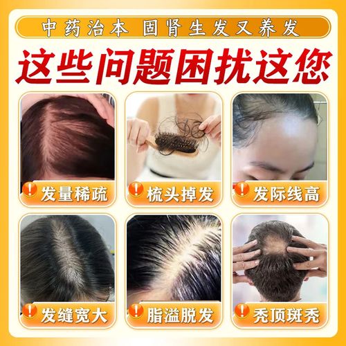 吃什么密发