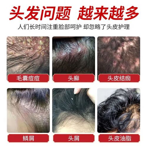 吃什么密发