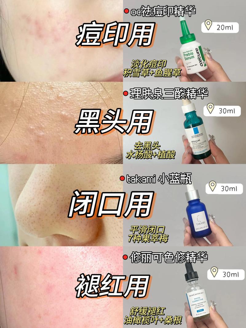 豆印豆坑怎么洗面奶