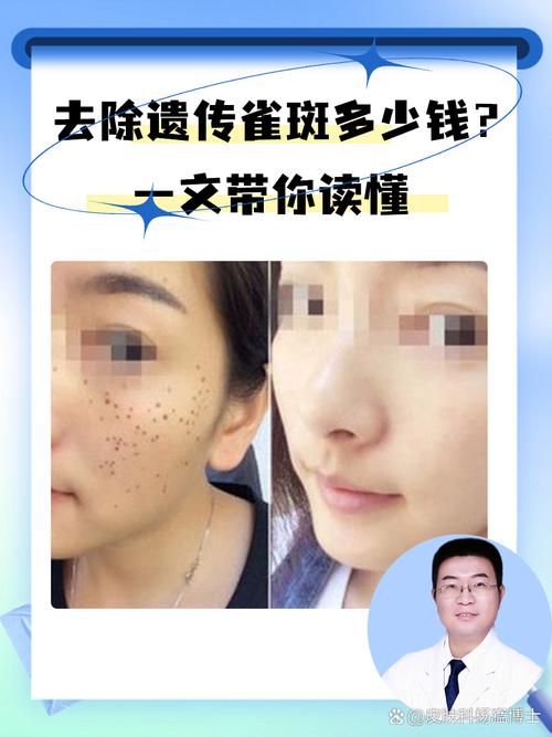 什么是遗传斑