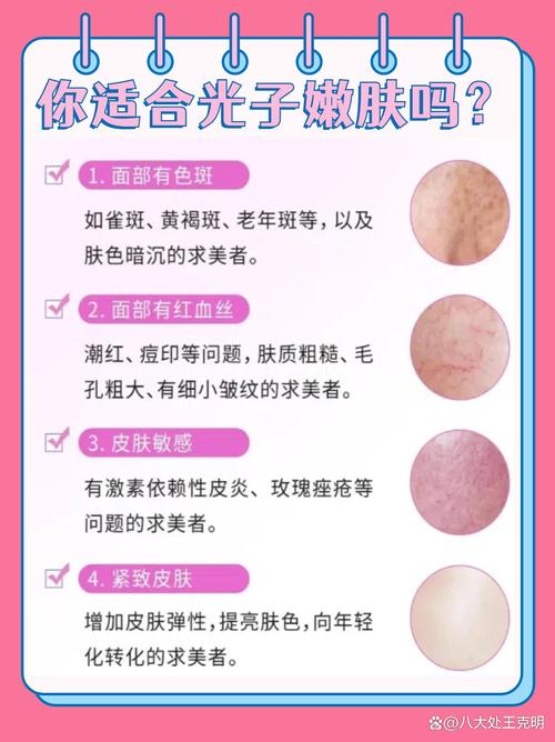 什么叫光子嫩肤