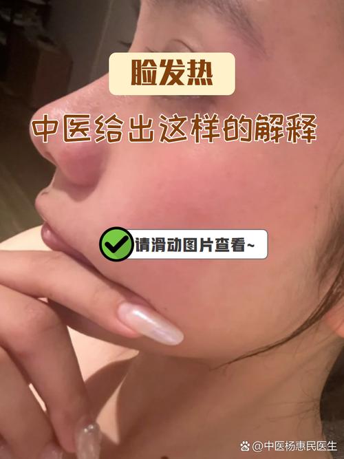 脸发热发红是什么原因