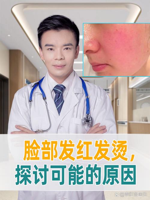 脸发热发红是什么原因
