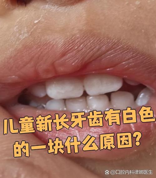 牙齿为什么是白色的