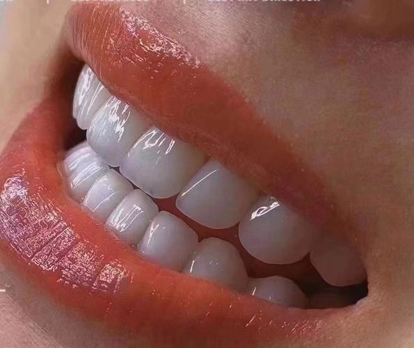 牙齿为什么是白色的