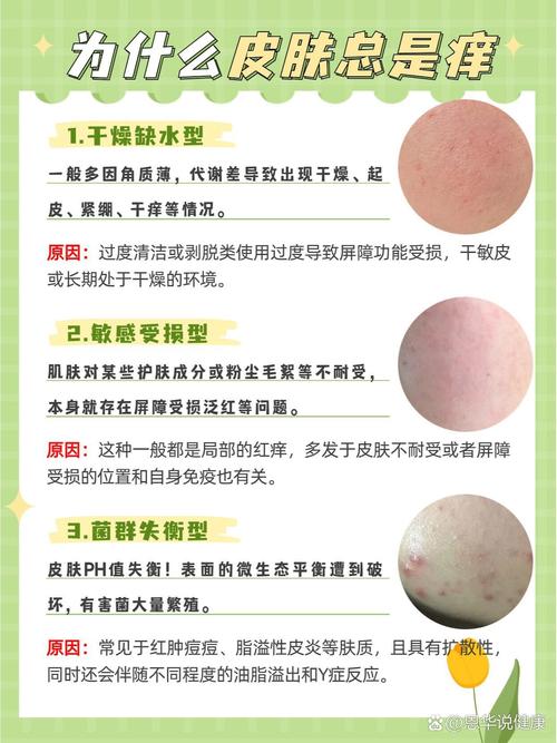 脸部瘙痒是什么原因