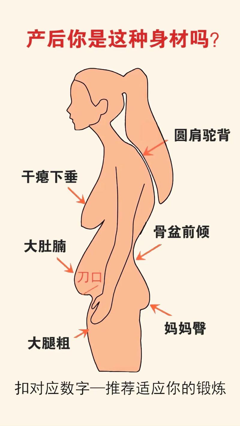 生完孩子什么运动可以减肥