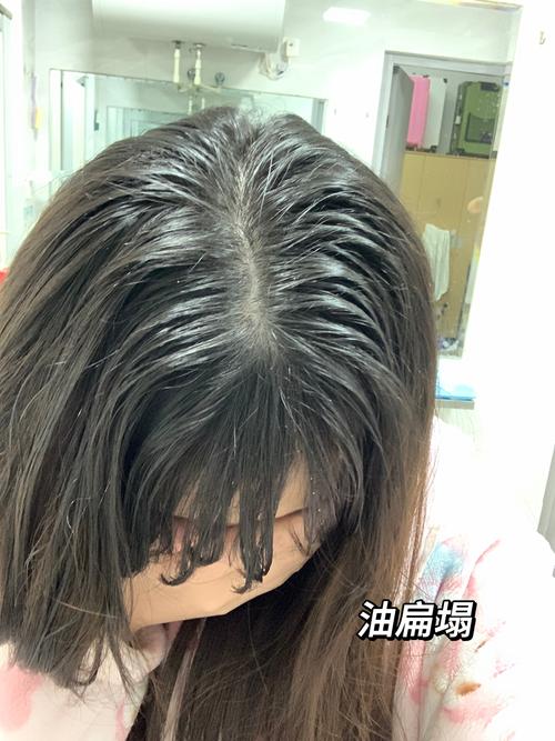 头发为什么这么油
