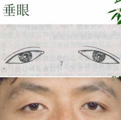 眼角向下是什么眼