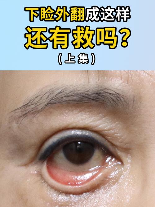 眼角向下是什么眼