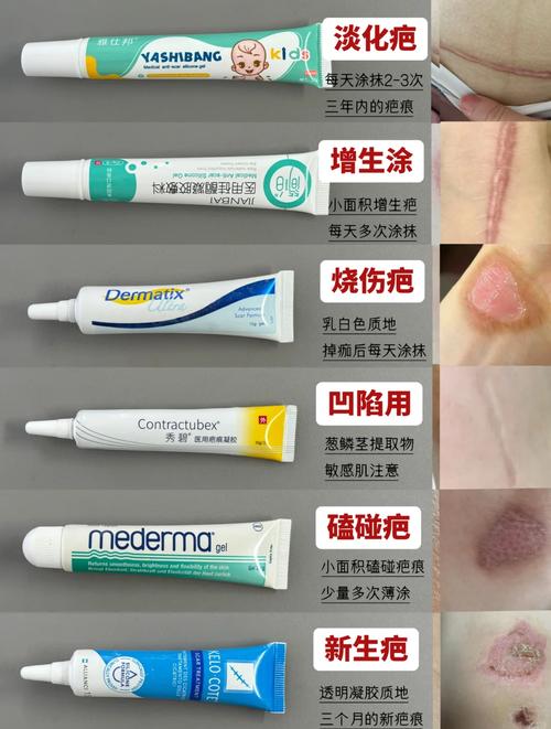 用什么去疤痕