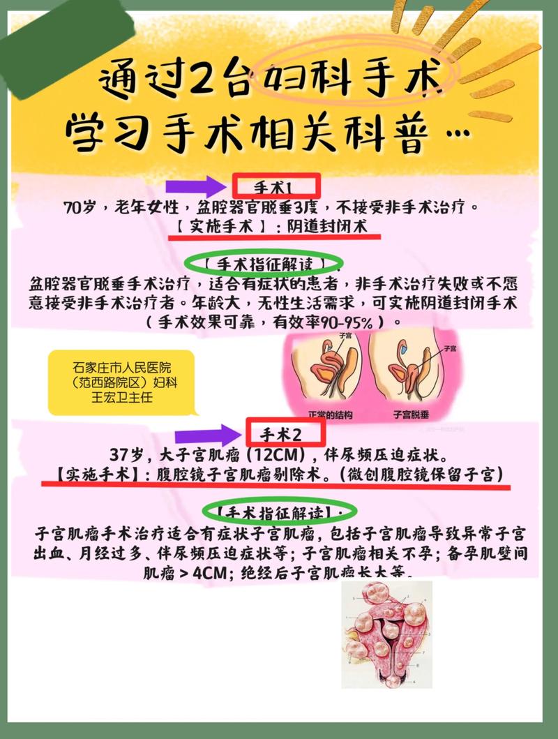 手术指征是什么意思