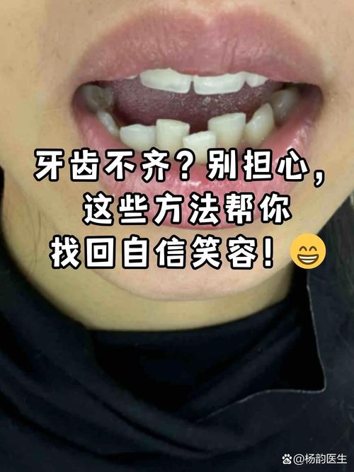 牙齿不齐是什么原因