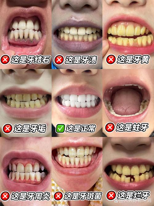 牙齿不齐是什么原因