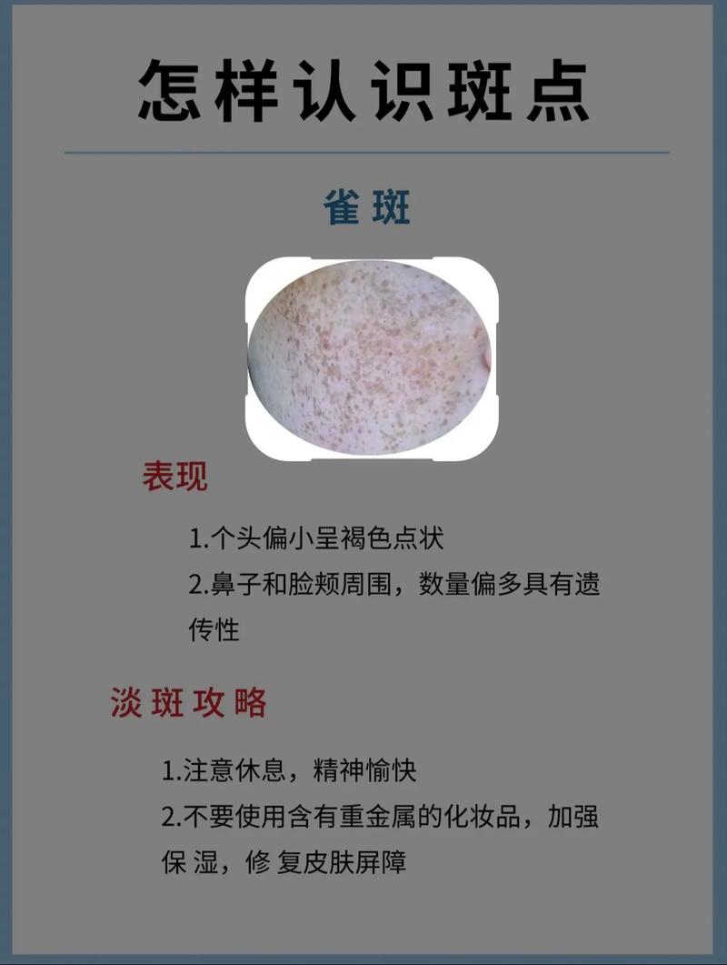 祛斑的方法有什么