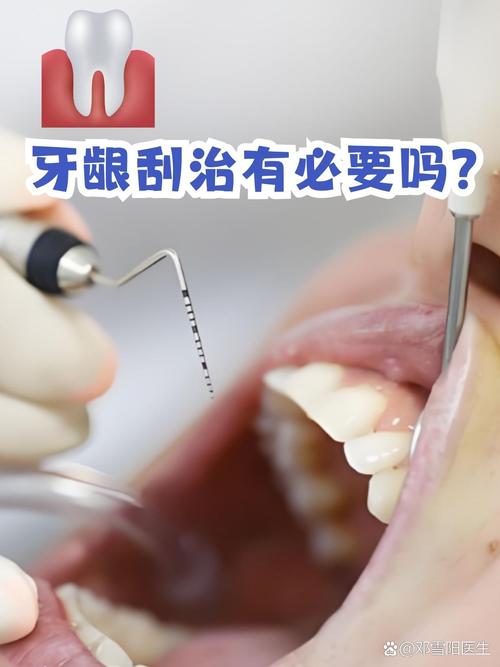 牙周刮治是什么
