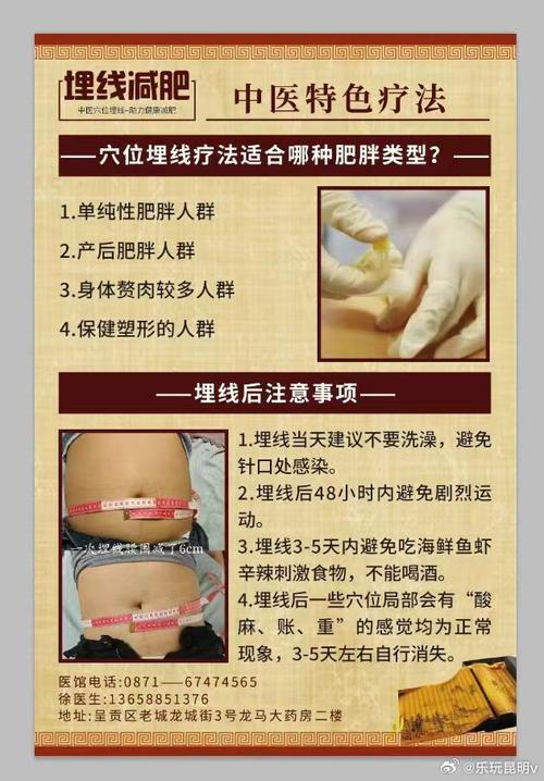什么是埋线减肥