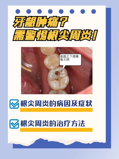 牙根为什么会发炎