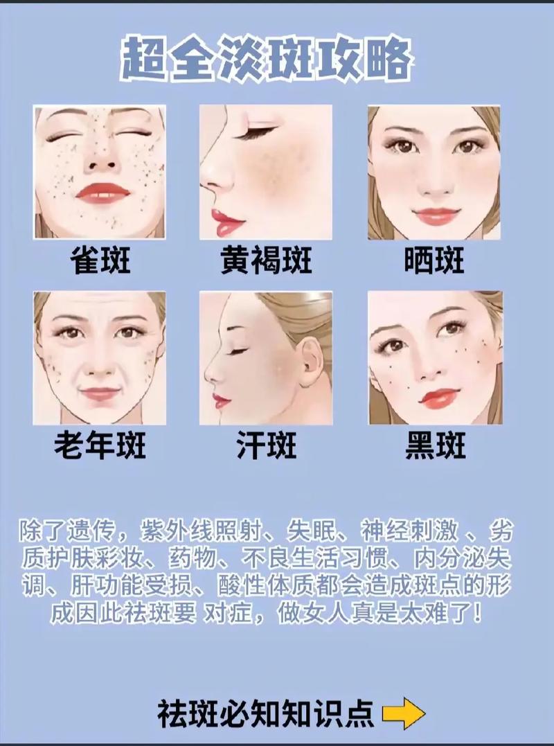 有什么祛斑方法