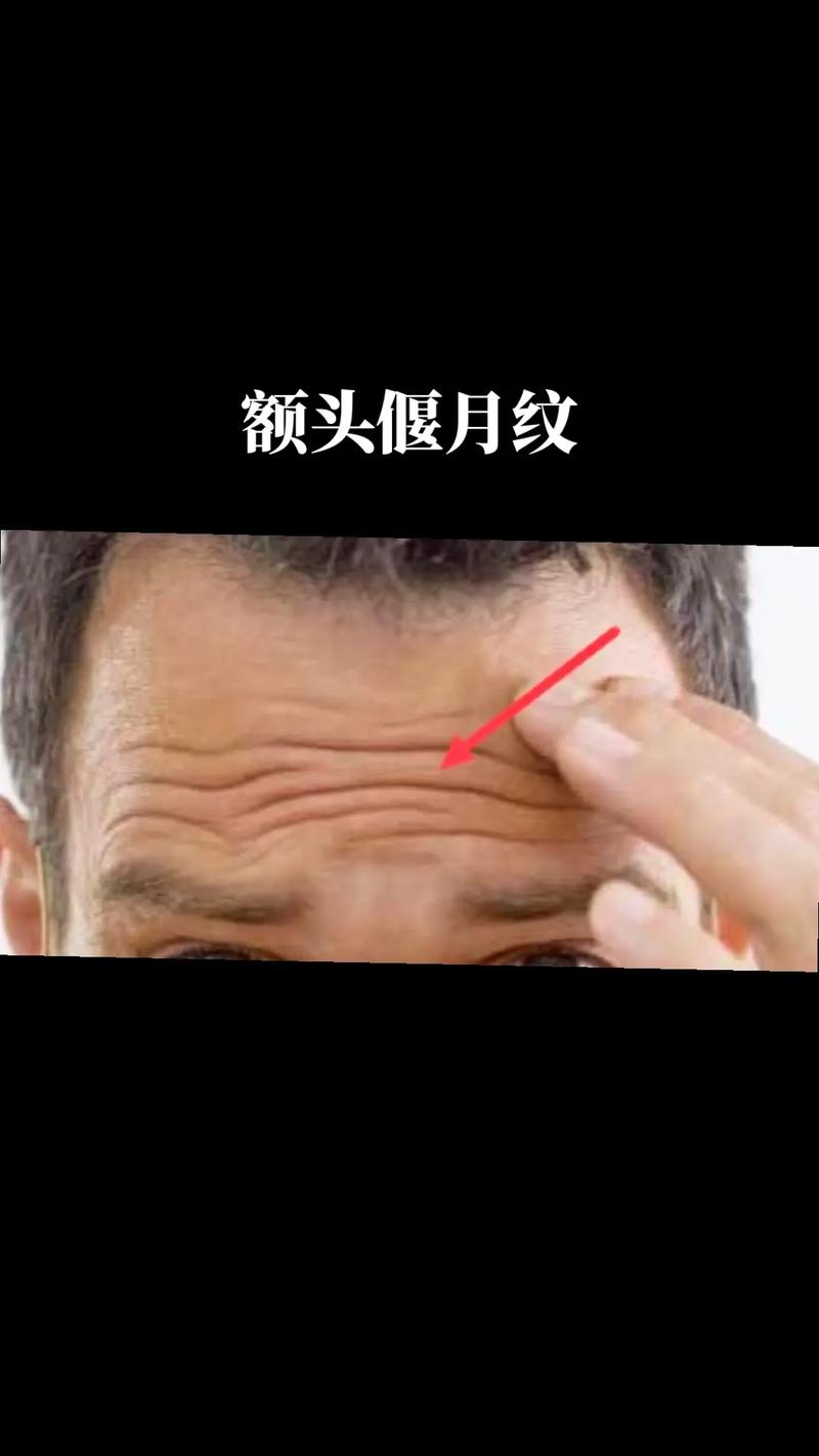 额头的皱纹叫什么