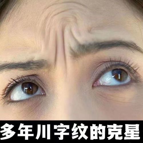 额头的皱纹叫什么