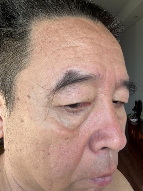 额头的皱纹叫什么