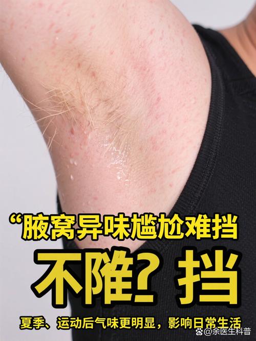 狐臭挂什么科治疗