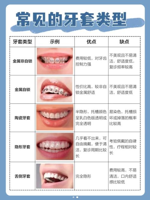 带牙套有什么好处