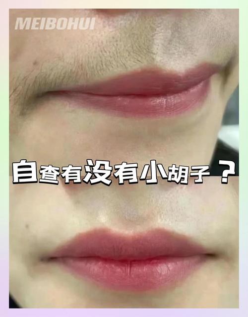 为什么女生长胡子