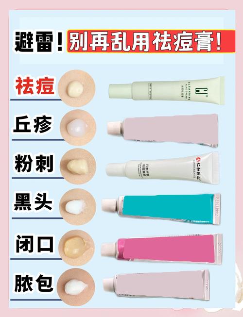 什么祛痘最快最有效