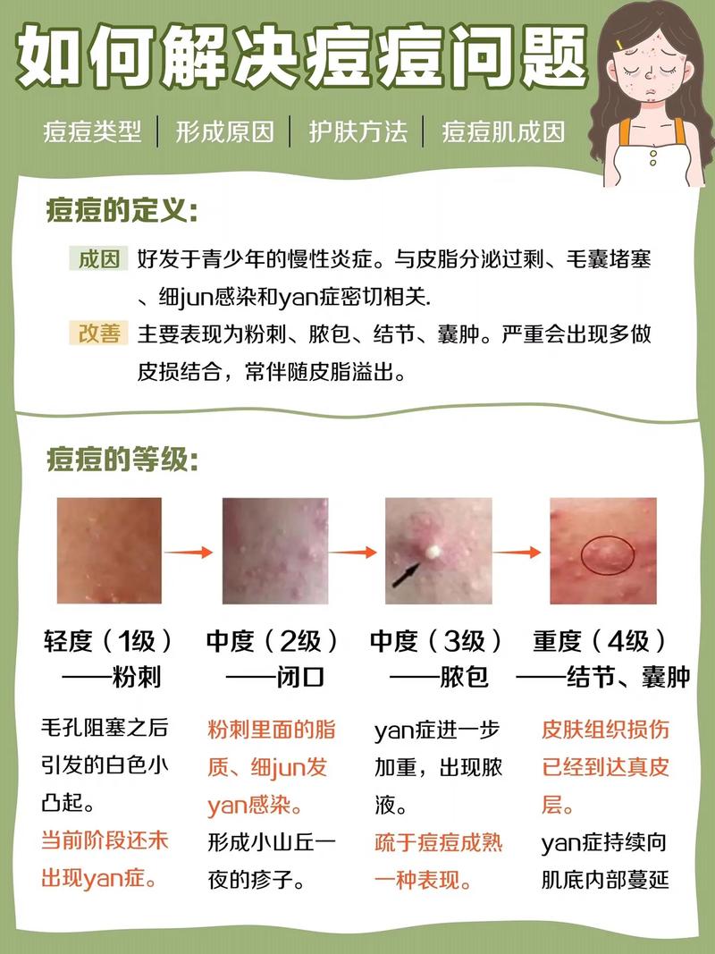什么祛痘最快最有效