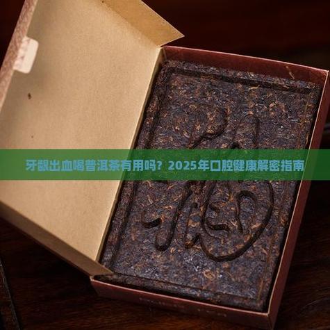 牙龈出血喝什么茶