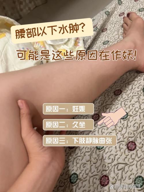 减肥水肿 为什么