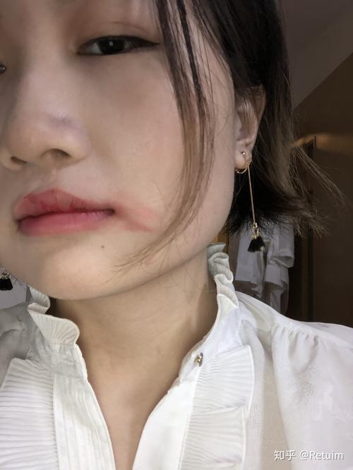 兔唇长什么样
